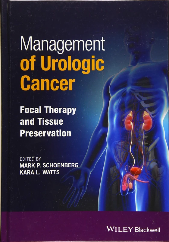 Management of Urologic Cancer: Focal Therapy and Tissue Preservation