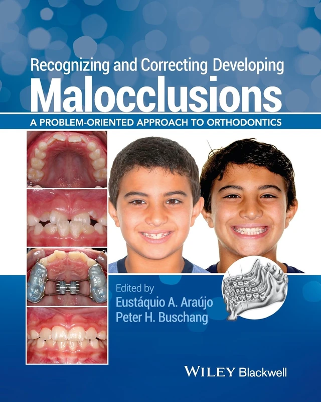 Wiley-Blackwell Recognizing and Correcting Malocclusions Book