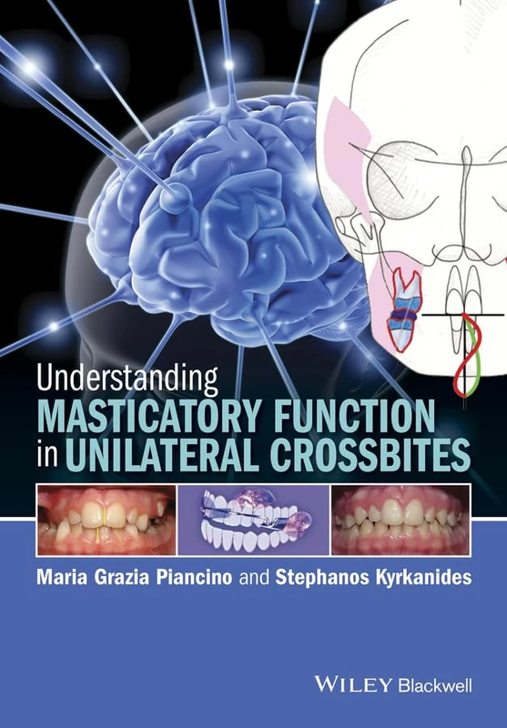 Understanding Masticatory Function in Unilateral Crossbites - Image 1