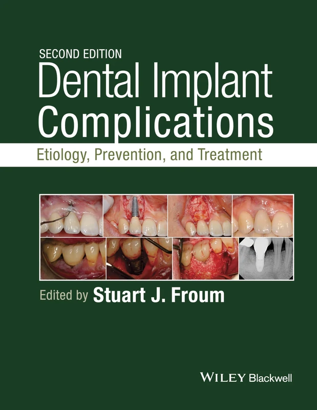 Dental Implant Complications: Etiology, Prevention, and Treatment