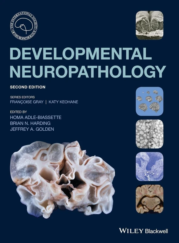 Wiley Developmental Neuropathology - ISN Series Book
