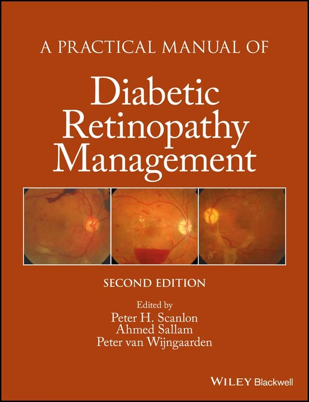 A Practical Manual of Diabetic Retinopathy Management (Practical Manual of Series)