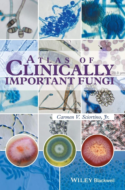 Wiley-Blackwell Atlas of Clinically Important Fungi