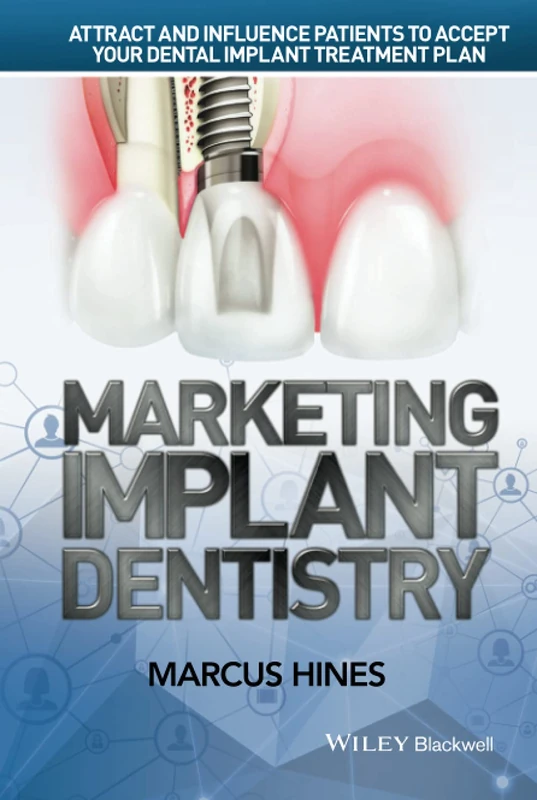 Marketing Implant Dentistry: Attract and Influence Patients to Accept Your Dental Implant Treatment Plan