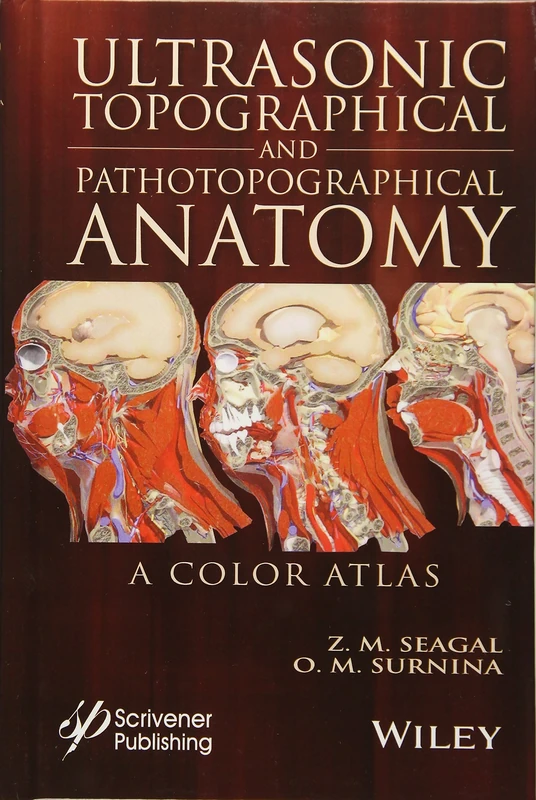 Ultrasonic Topographical and Pathotopographical Anatomy: A Color Atlas