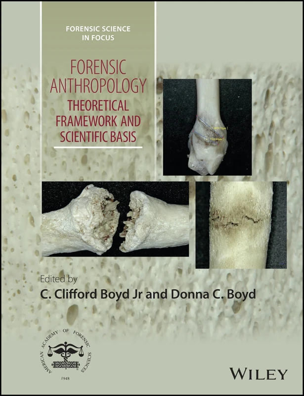 Forensic Anthropology: Theoretical Framework and Scientific Basis (Forensic Science in Focus)