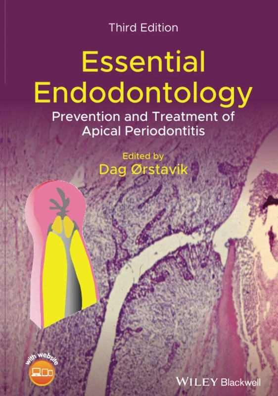 Essential Endodontology: Prevention and Treatment of Apical Periodontitis