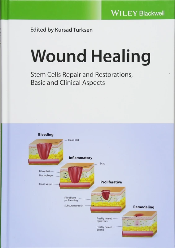 Wiley Wound Healing: Stem Cells Repair and Restorations Book