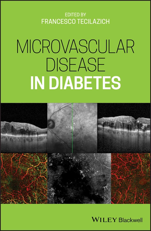 Wiley-Blackwell - Microvascular Disease in Diabetes Book