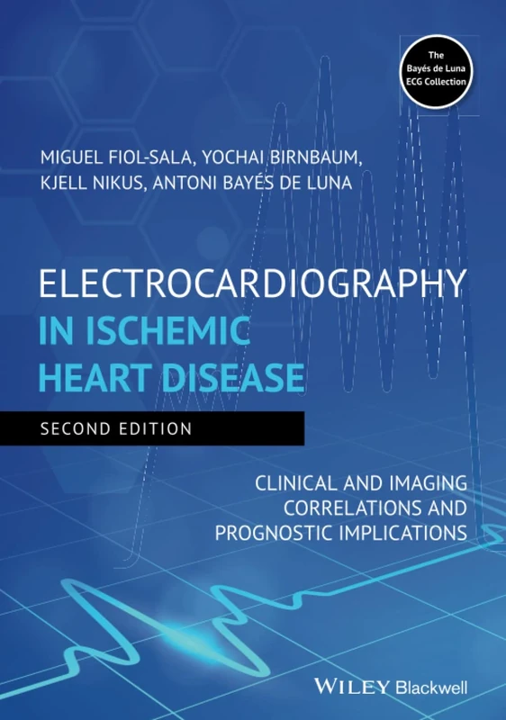 Electrocardiography in Ischemic Heart Disease: Clinical and Imaging Correlations and Prognostic Implications