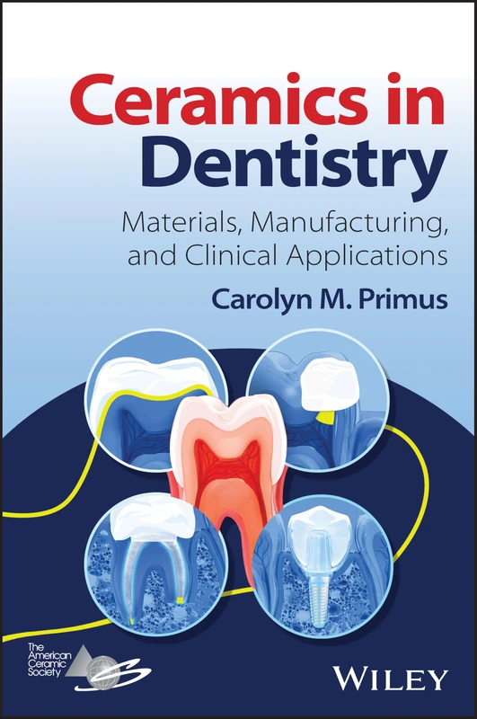 Ceramics in Dentistry - John Wiley & Sons Materials Book