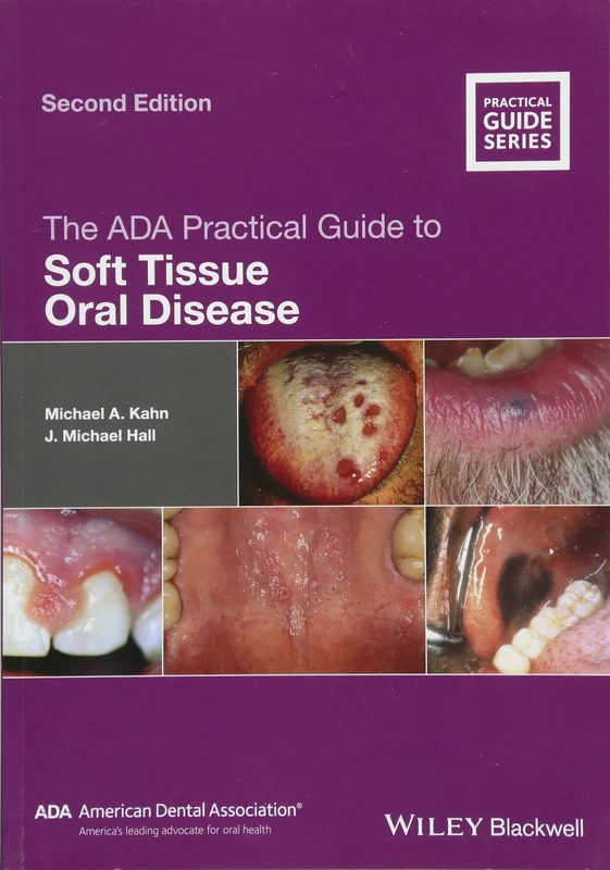 The ADA Practical Guide to Soft Tissue Oral Disease, 2nd Edition