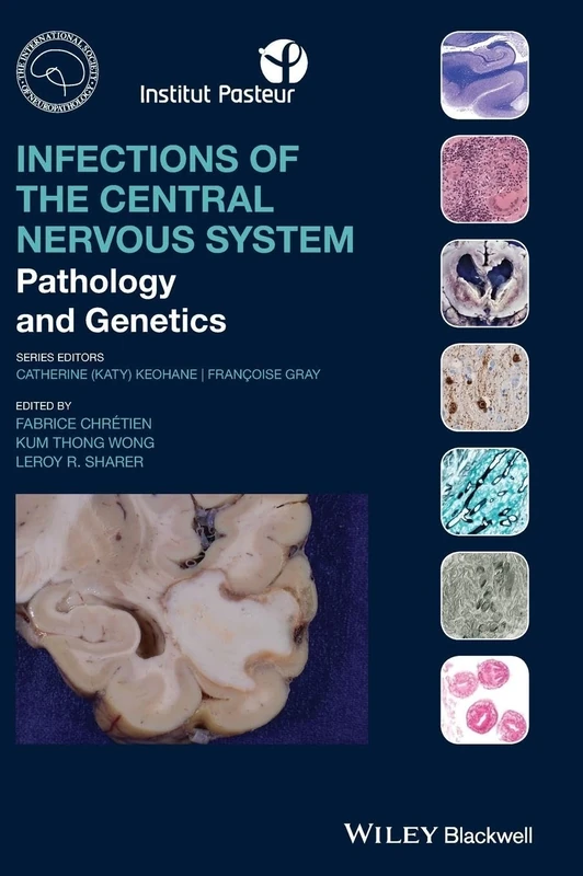 Infections of the Central Nervous System: Pathology and Genetics (International Society of Neuropathology Series) - Image 1