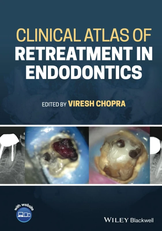 Clinical Atlas of Retreatment in Endodontics: Includes Website