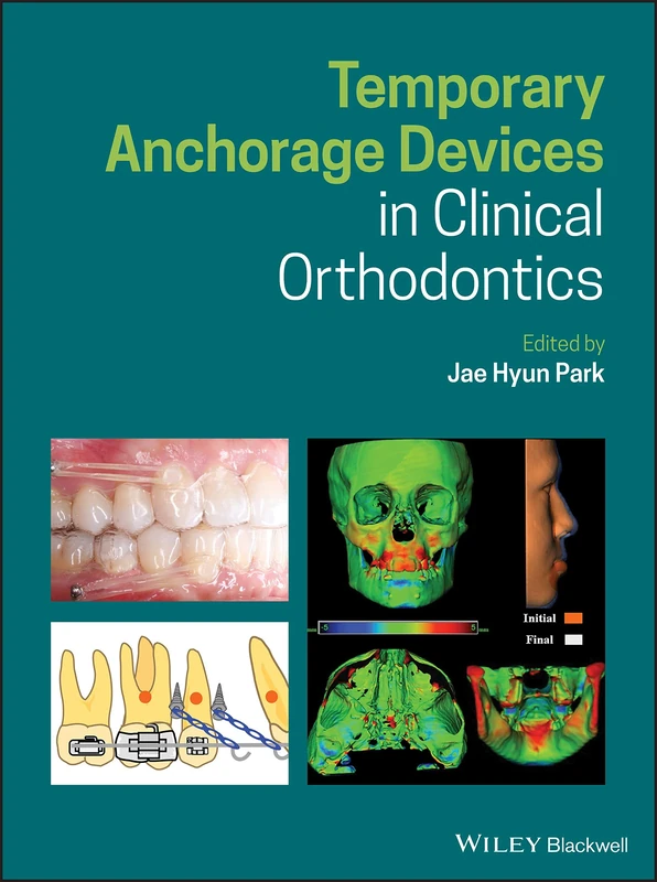 Temporary Anchorage Devices in Clinical Orthodontics - Image 1