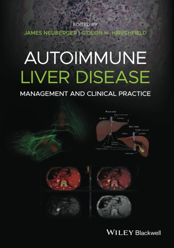 Autoimmune Liver Disease: Management and Clinical Practice