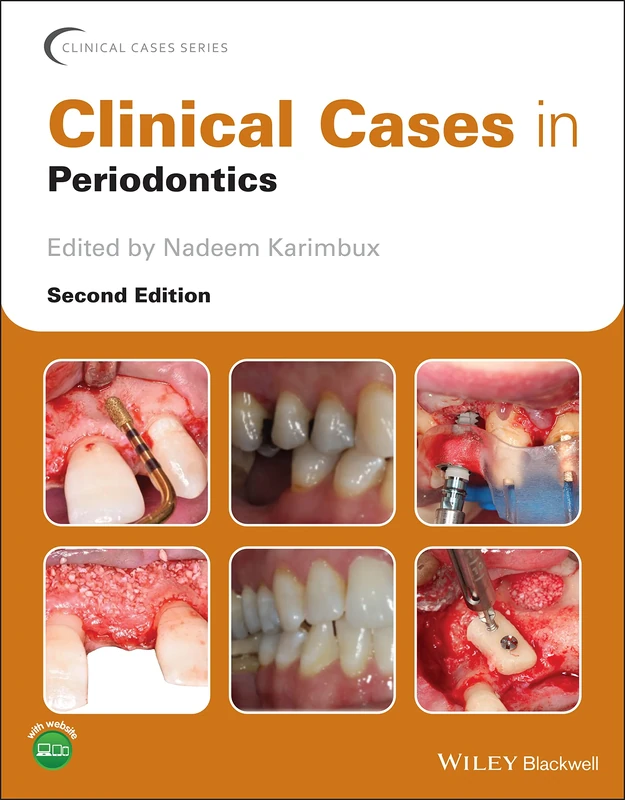Clinical Cases in Periodontics (Clinical Cases (Dentistry))