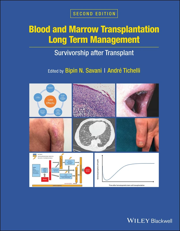 Blood and Marrow Transplantation Long Term Management: Survivorship after Transplant
