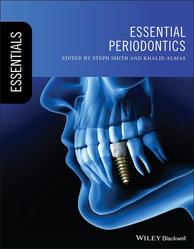 Essential Periodontics (Essentials (Dentistry))