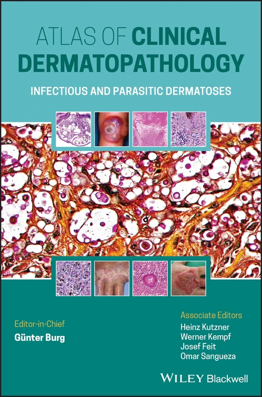 Atlas of Clinical Dermatopathology: Infectious and Parasitic Dermatoses