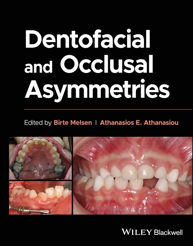 Dentofacial and Occlusal Asymmetries