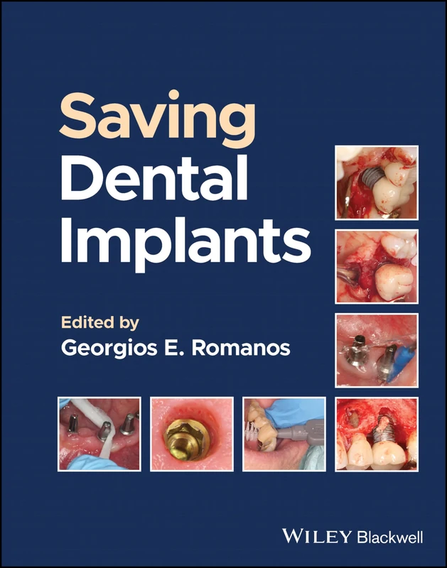 Wiley-Blackwell Saving Dental Implants - ABIS Book - Image 1
