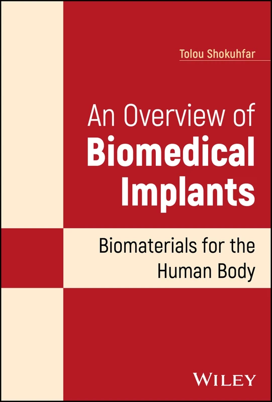 Wiley - An Overview of Biomedical Implants: Biomaterials Book