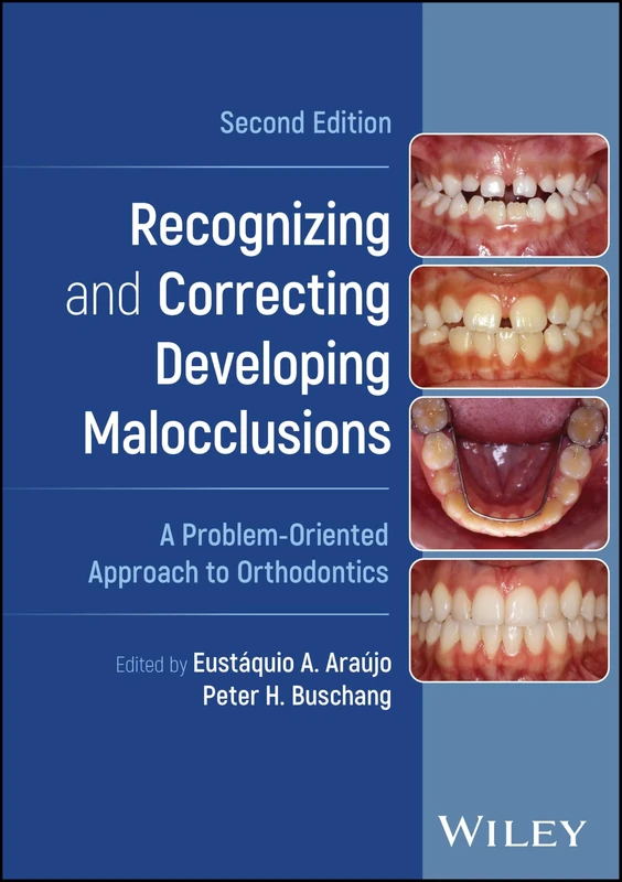 Recognizing and Correcting Developing Malocclusions: A Problem-Oriented Approach to Orthodontics