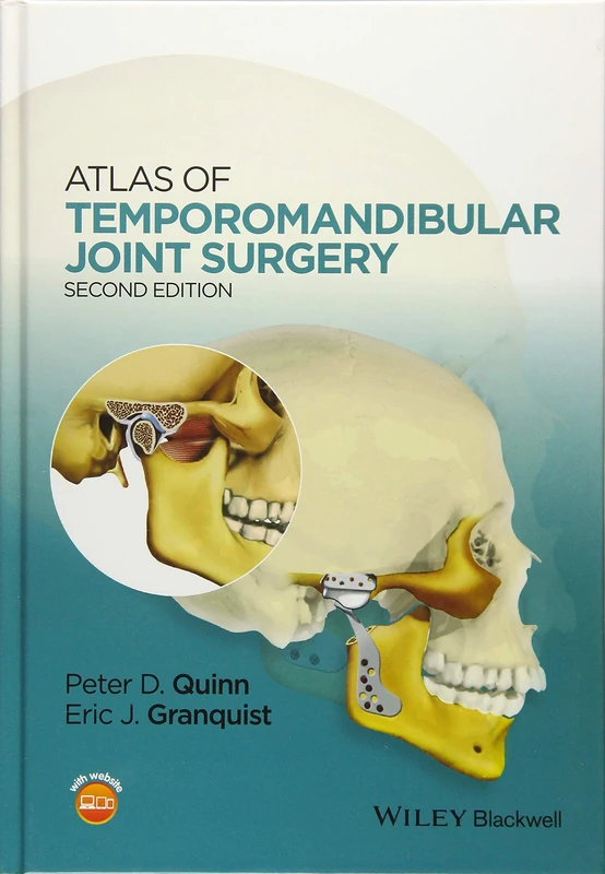 Atlas of Temporomandibular Joint Surgery
