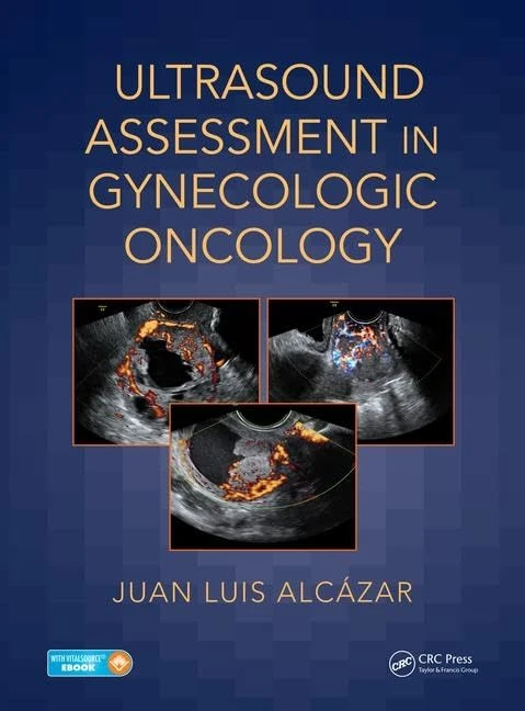 CRC Press Ultrasound Assessment in Gynecologic Oncology Book