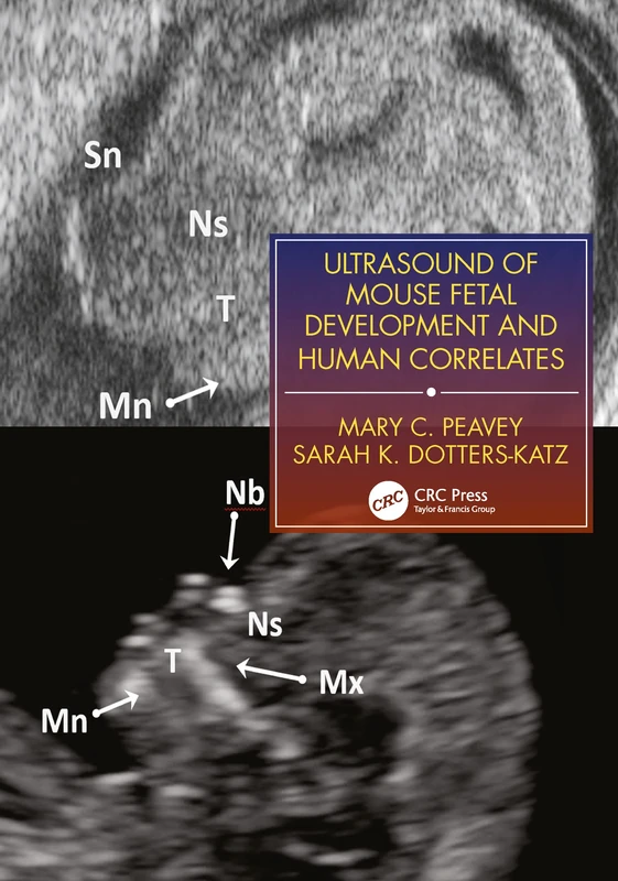 Ultrasound of Mouse Fetal Development and Human Correlates (Reproductive Medicine and Assisted Reproductive Techniques Series)