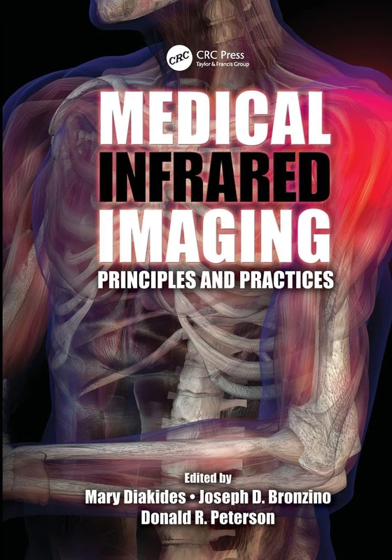 Medical Infrared Imaging: Principles and Practices