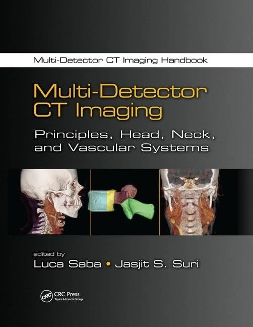 Multi-Detector CT Imaging: Principles, Head, Neck, and Vascular Systems