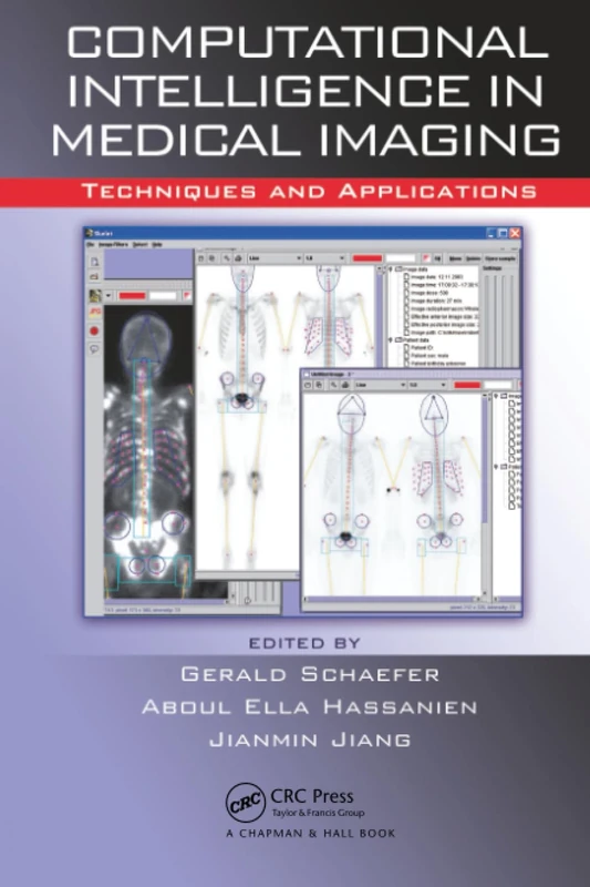 Computational Intelligence in Medical Imaging: Techniques and Applications