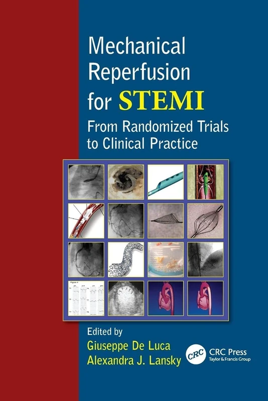 Mechanical Reperfusion for STEMI: From Randomized Trials to Clinical Practice