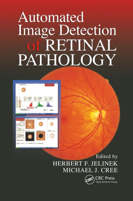 Automated Image Detection of Retinal Pathology