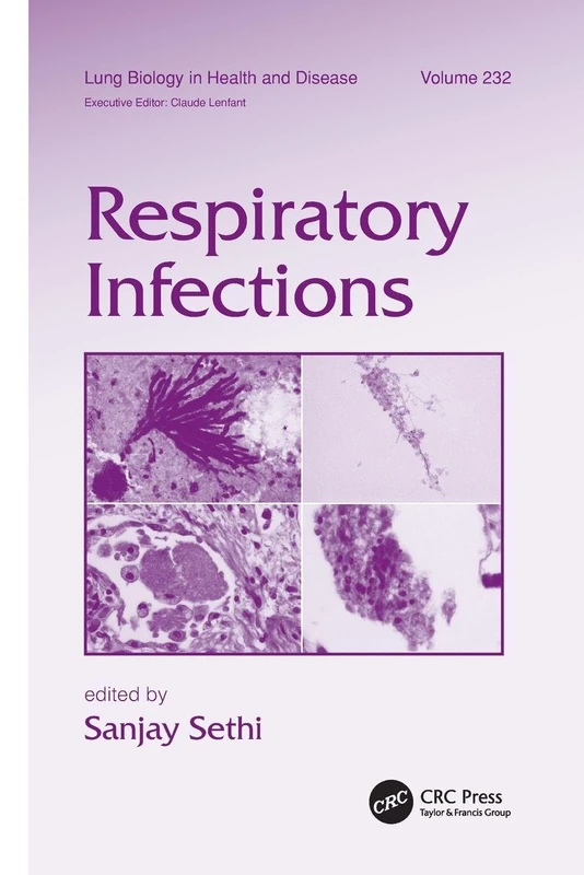 Respiratory Infections: 232 (Lung Biology in Health and Disease)