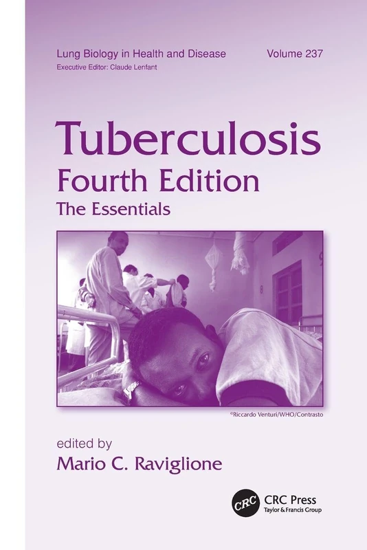 Tuberculosis: The Essentials, Fourth Edition (Lung Biology in Health and Disease)