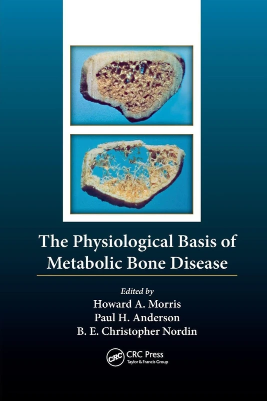 The Physiological Basis of Metabolic Bone Disease