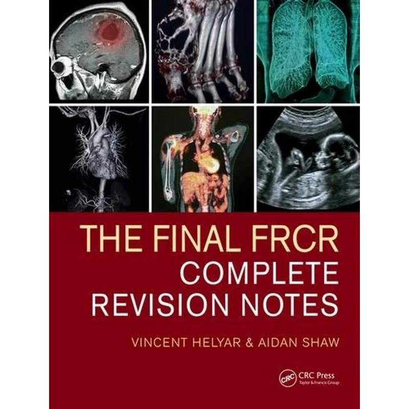 The Final FRCR: Complete Revision Notes