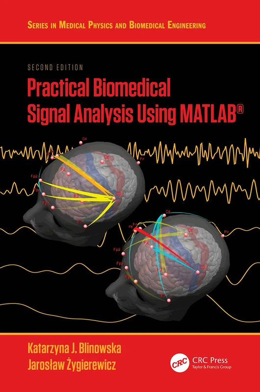 Practical Biomedical Signal Analysis Using MATLAB® (Series in Medical Physics and Biomedical Engineering)