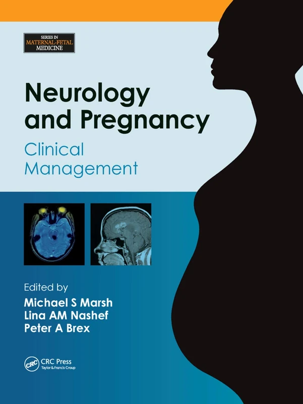 Neurology and Pregnancy: Clinical Management (Series in Maternal-Fetal Medicine)