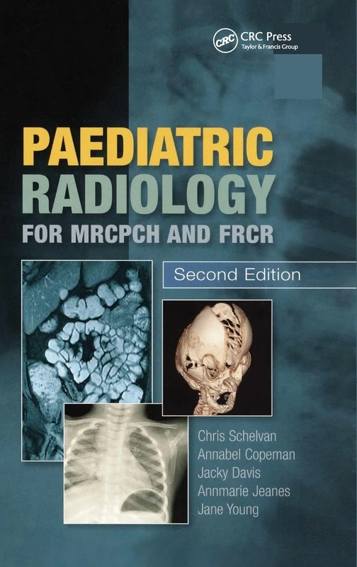CRC Press Paediatric Radiology for MRCPCH and FRCR, 2nd Edition