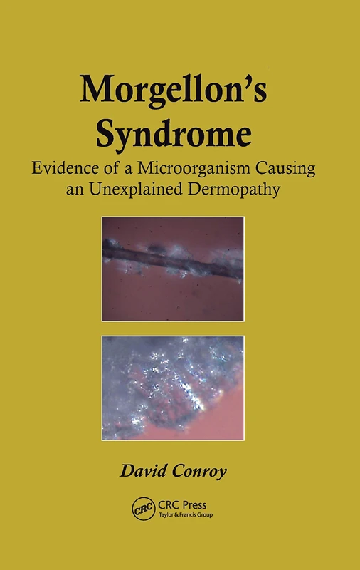 Morgellon's Syndrome: Evidence of a Microorganism Causing an Unexplained Dermopathy - Image 1