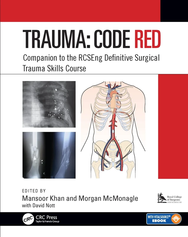 Trauma: Code Red: Companion to the RCSEng Definitive Surgical Trauma Skills Course