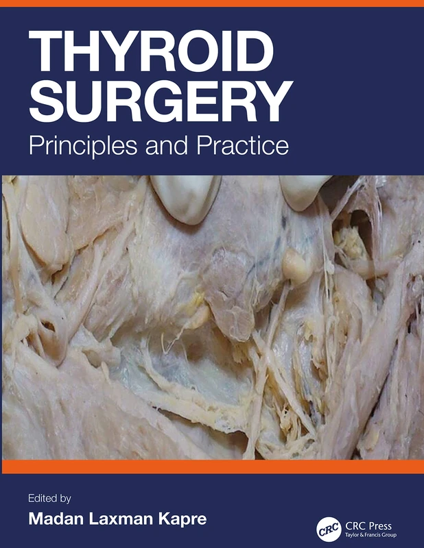 Thyroid Surgery: Principles and Practice