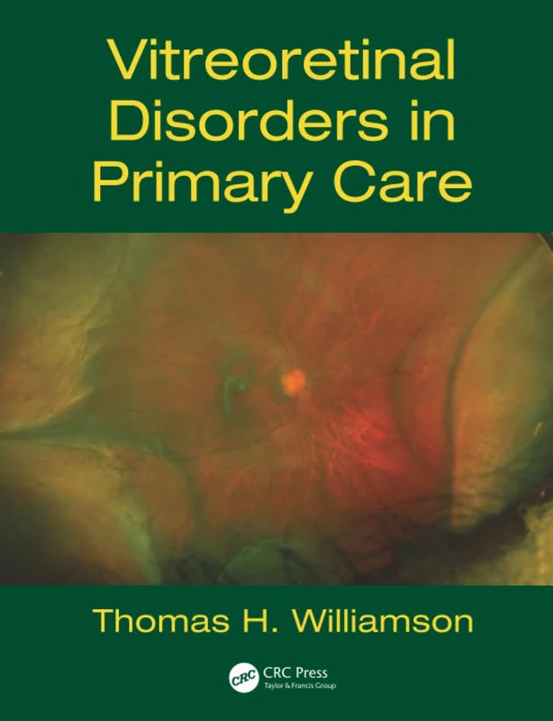 Vitreoretinal Disorders in Primary Care
