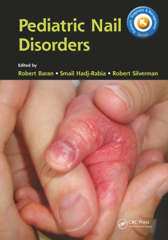 Pediatric Nail Disorders (Pediatric Diagnosis and Management)