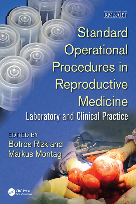 Standard Operational Procedures in Reproductive Medicine: Laboratory and Clinical Practice (Reproductive Medicine and Assisted Reproductive Techniques Series)