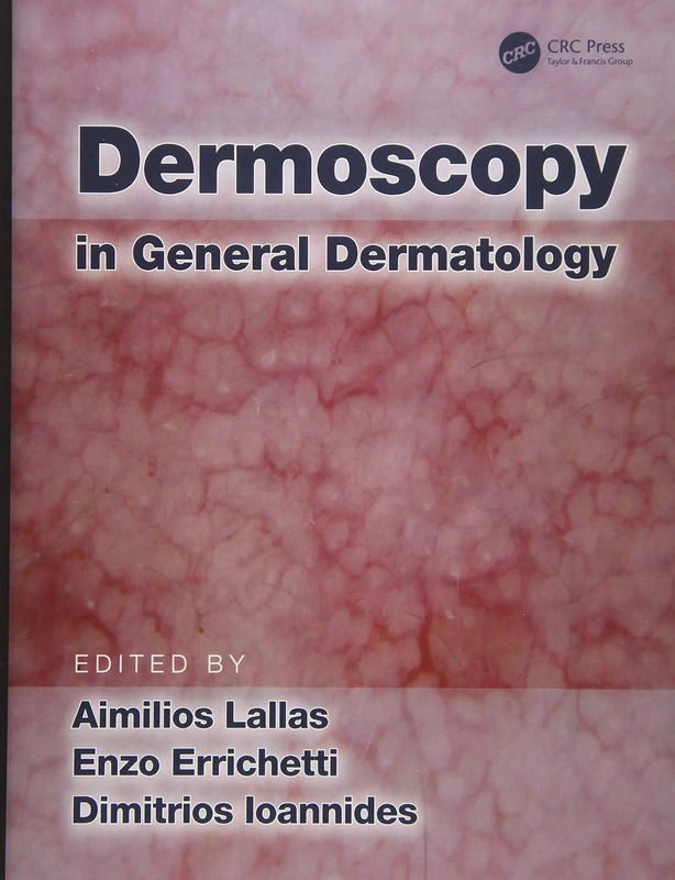 Dermoscopy in General Dermatology - Image 1